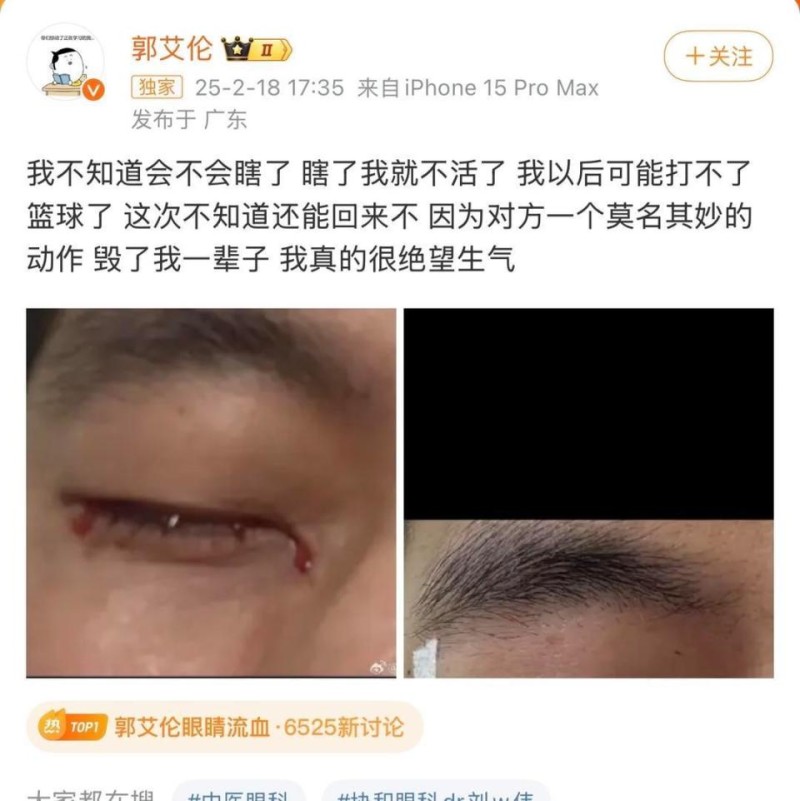 知名篮球运动员郭艾伦自曝眼部受伤，俱乐部：昨日训练中受伤，在场球员都很自责